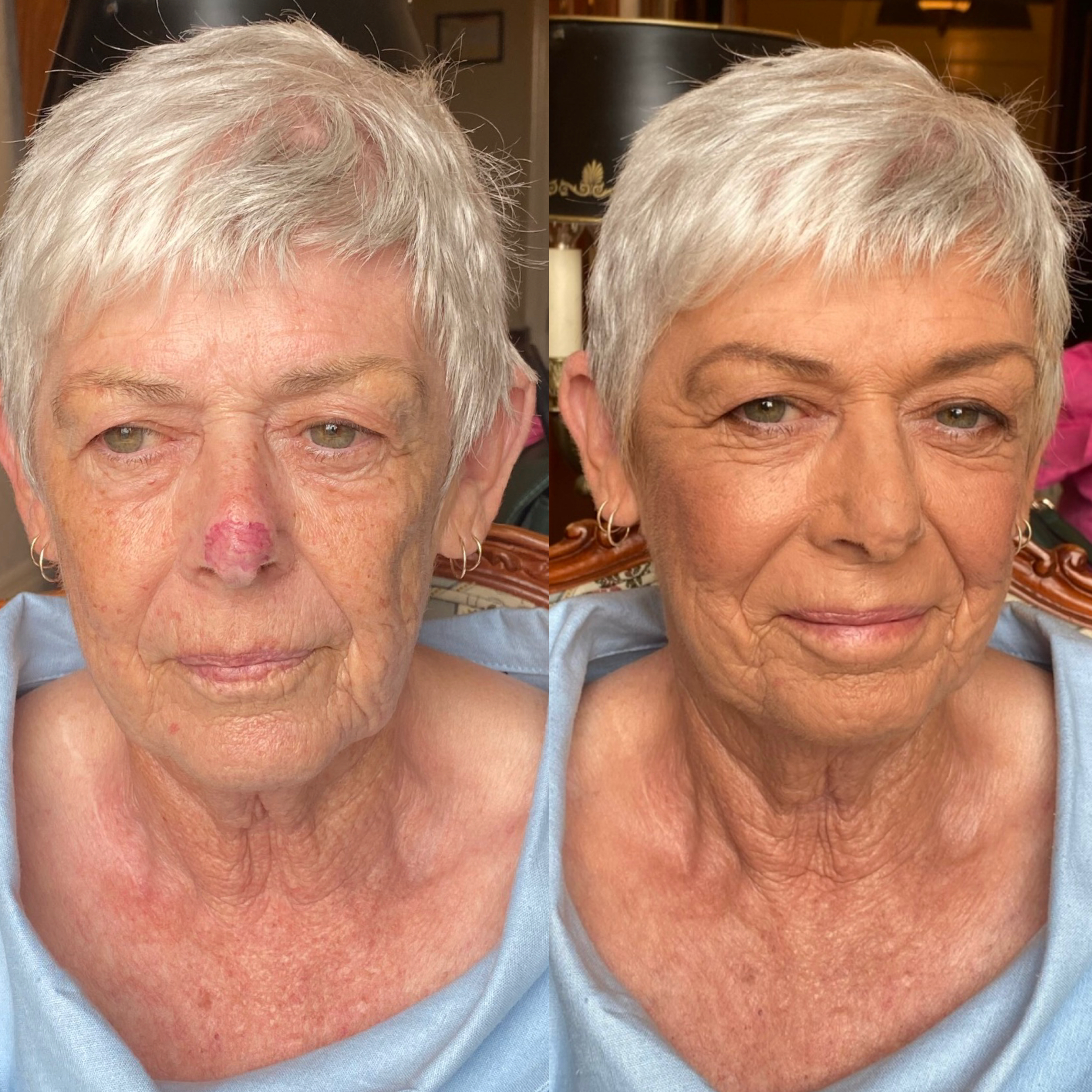 Camouflage Makeup by Tania de Ross